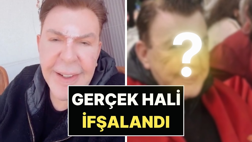 Yüz Gerdirme Ameliyatı Olan Kuşum Aydın'ın Filtresiz "Gerçek" Hali Ortaya Çıktı!