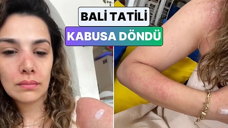 Bali'de Kirli Sudan Mikrop Kapan Genç Kadın Ülkedeki Hastane Sürecini Paylaştı