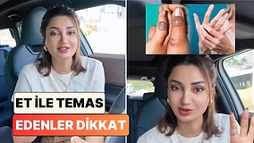 Cildiye Poliklinikleri Bayram Sonrası Doluyor: Bir Doktor Çiğ Et Temasıyla Bulaşan Orf Virüsü'nü Anlattı
