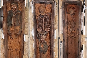 Painful Lives of Historic Whale Hunters Revealed in Skeletons Marked by Scurvy