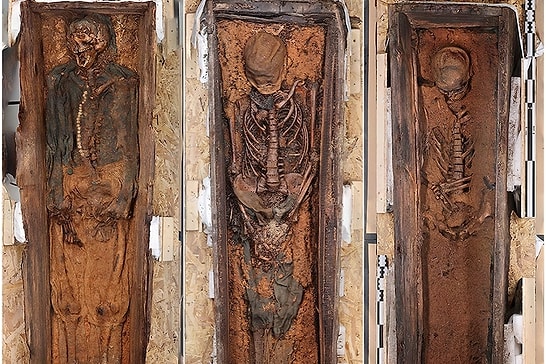 Painful Lives of Historic Whale Hunters Revealed in Skeletons Marked by Scurvy