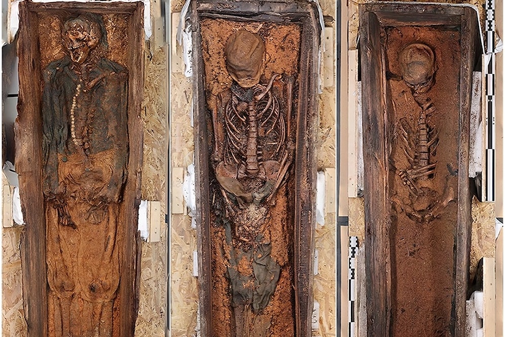 Painful Lives of Historic Whale Hunters Revealed in Skeletons Marked by Scurvy