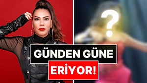 73 Kilo Vermişti: Erimeye Devam Eden Işın Karaca'nın Son Hali Ağızları Açık Bıraktı!