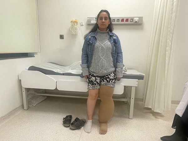 Sıvı tahliyesinin ardından hastaya özel bası giysileri giydirilerek süreç egzersiz programlarıyla desteklendi