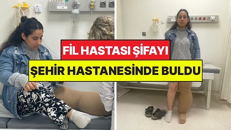 İstanbul'da Fil Hastası 4 Yıl Sonra Şehir Hastanesinde Şifa Buldu