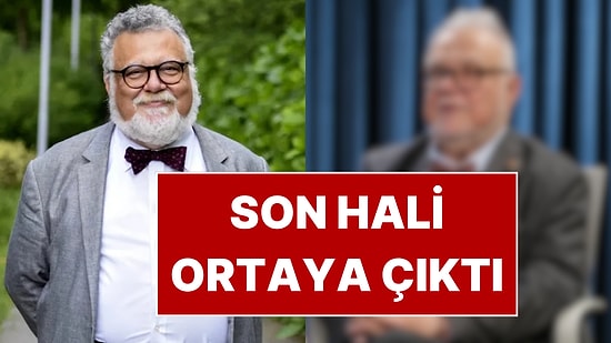 50 Kilo Veren Celal Şengör'ün Son Hali Ortaya Çıktı