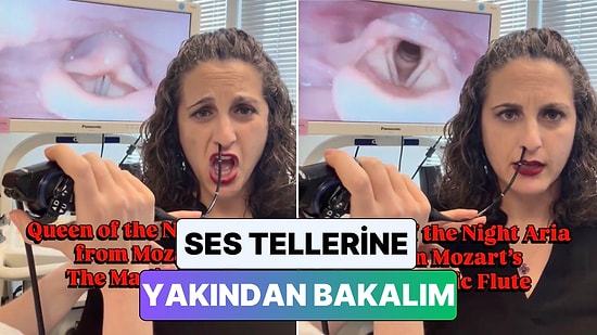 Bir Opera Sanatçısının Şarkı Söylerken Ses Tellerinde Yaşanan Değişim Kamera ile Görüntülendi
