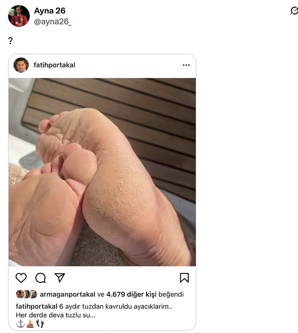 Fatih Portakal'ın ayakları da "ne alaka" dedirtmişti.