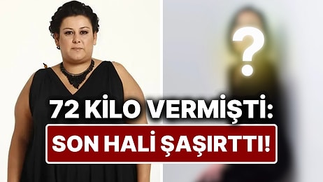 72 Kilo Veren Esin Gündoğdu'nun Son Hali Görenleri Şaşırttı!
