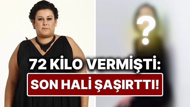 72 Kilo Veren Esin Gündoğdu'nun Son Hali Görenleri Şaşırttı!