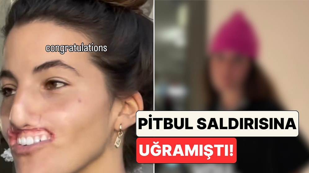 Pitbul Saldırısında Üst Dudağını Tamamen Kaybeden Genç Kadının Ameliyatlarla Yaşadığı Değişimi Paylaştı