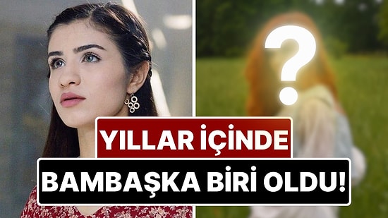 Feride Hilal Akın'ın Yıllar İçindeki Değişimi Görenleri Şaşkına Çevirdi!