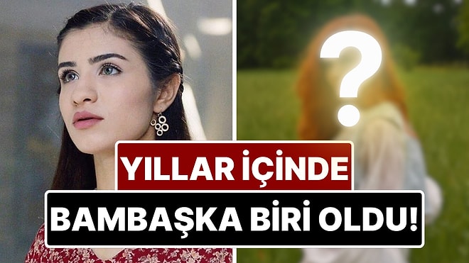 Feride Hilal Akın'ın Yıllar İçindeki Değişimi Görenleri Şaşkına Çevirdi!