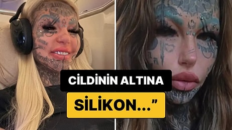 Dünyanın En Dövmeli Kadınının Yasaklı Estetik Operasyonu Sosyal Medyada Gündem Oldu