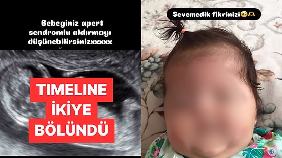 Doktorun Uyarısına Rağmen Bebeğini Aldırmayan Anne Sosyal Medyayı İkiye Böldü