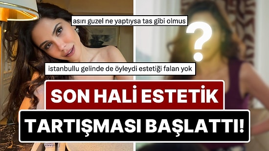 Dilara Aksüyek'in Son Hali Kullanıcılar Arasında Estetik Tartışması Yarattı!