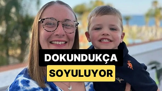 Küçük Bir Dokunuş Bile Yetiyor: Anne ve Oğlunun Nadir Hastalıkla Zorlu Yaşamı