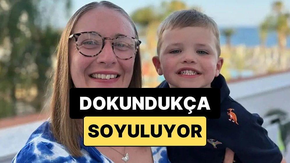 Küçük Bir Dokunuş Bile Yetiyor: Anne ve Oğlunun Nadir Hastalıkla Zorlu Yaşamı