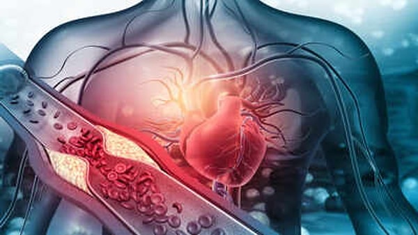 En sık rastlanan ritim bozukluklarının başında gelen Atriyal Fibrilasyon (AFib), kalbin üst odacıklarının alt odacıklarla uyumsuz ve düzensiz bir şekilde kasılmasıyla ortaya çıkıyor.