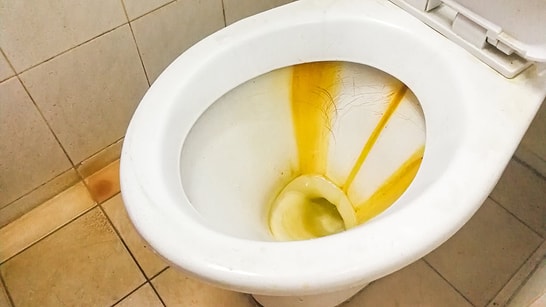 No More Scrubbing: This One Household Item Will Make Stained Toilets Look Brand New
