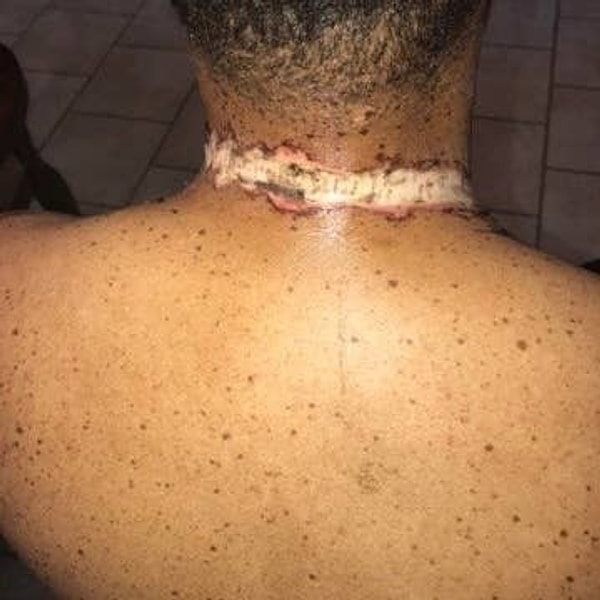 In a desperate bid for freedom, Day managed to tear the chain from his neck, ripping into his skin in the process. His family, alerted by his screams, promptly rushed him to the hospital.