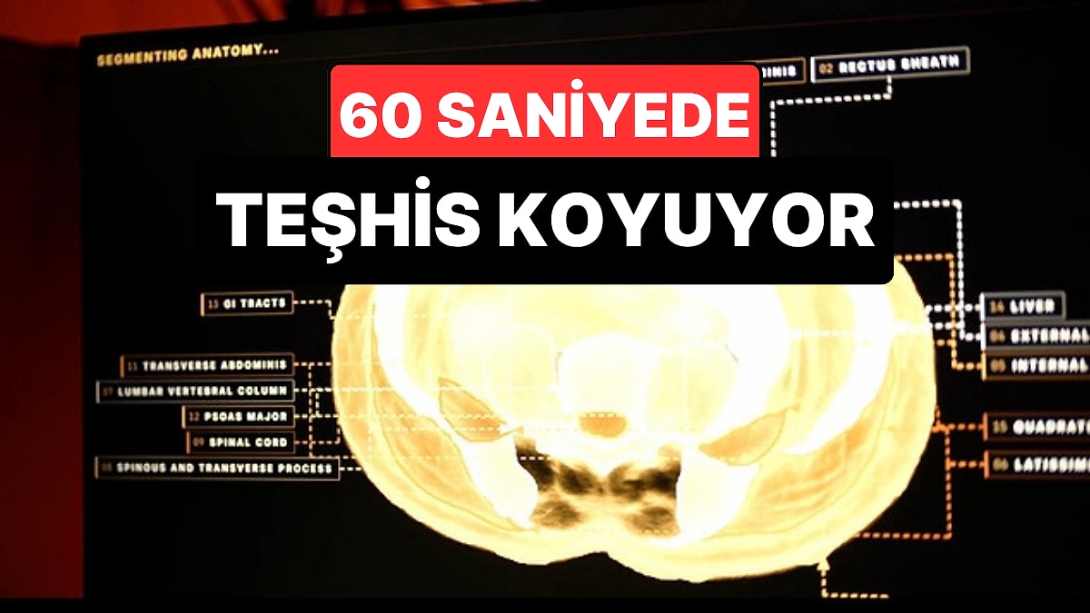 Midjourney'den Sağlık Teknolojisinde Yeni Dönem: Tüm Vücudu 60 Saniyede Tarayacak
