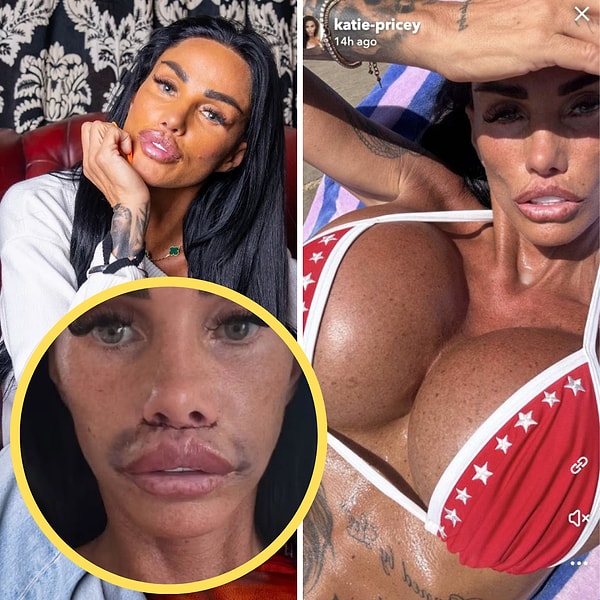 Katie Price'ın yıllar içindeki dönüşümü, kariyer hikayesinden bile daha fazla konuşuldu.