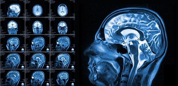 An experiment was conducted with 115 individuals, none of whom had any criminal records or clinical psychiatric diagnoses.