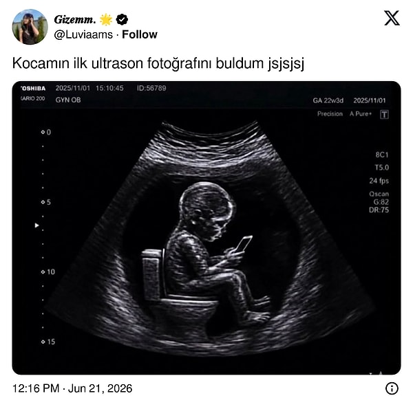 Olmadı.