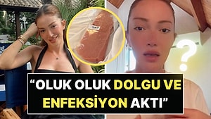 Gece Saatlerinde Acilen Ameliyata Alınan Danla Bilic Yaşadığı Korkunç Olayı Anlattı!
