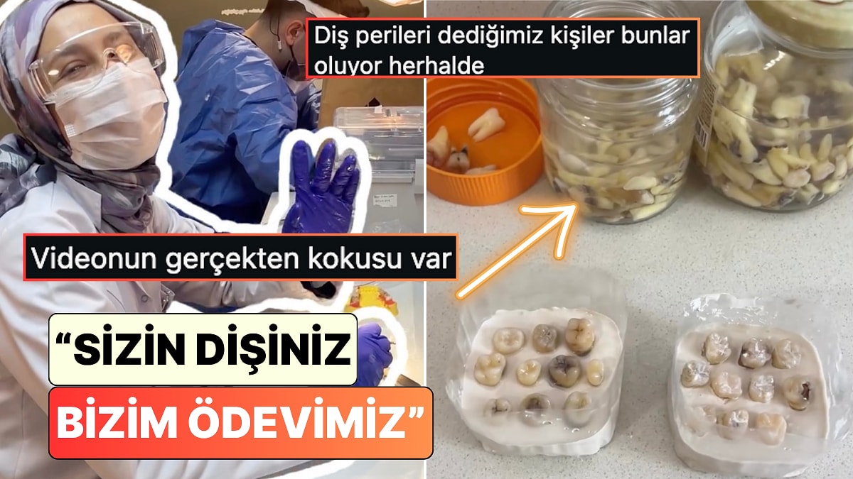 Bir Diş Hekimliği Öğrencisi Gerçek İnsan Dişleri Üzerinde Yaptıkları Çalışmayı Paylaştı