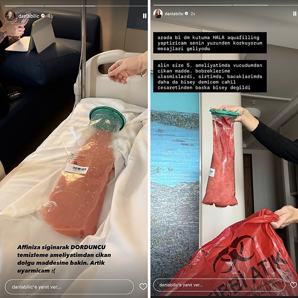 Danla Bilic, a figure who causes a stir with every move she makes, has been incessantly talking about one particular issue for the last two years: a matter of fillers!