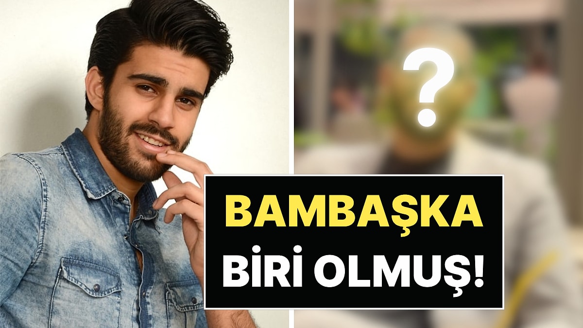 Kısmetse Olur Adnan Kızıltaş, Yıllar Sonra Yeni İmajıyla Dikkat Çekti!