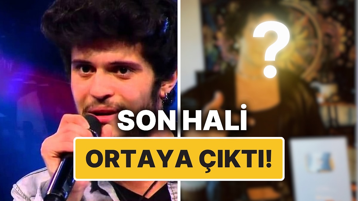 O Ses Türkiye Şampiyonu Emre Sertkaya Yeni İmajıyla Şaşırttı