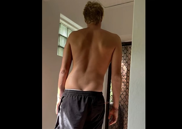 The physical toll of extreme sports.