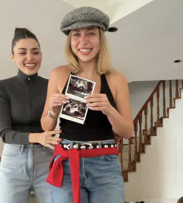 Not only the actress Hande Erçel, but also her sister Gamze Erçel has been a figure closely followed by the entertainment world for many years.