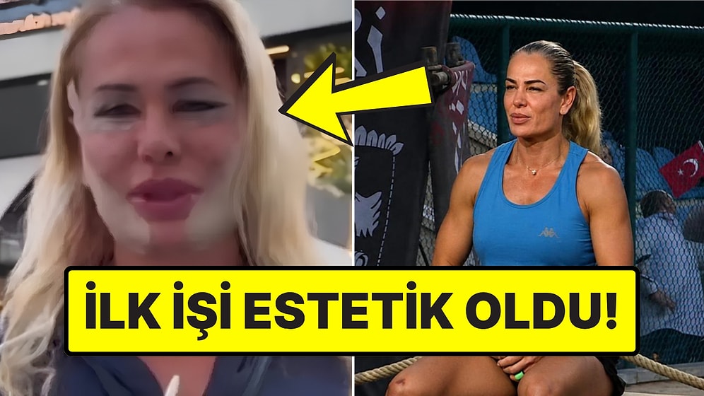 Survivor Sonrası Estetik Yaptıran Nagihan Karadere'nin Son Hali