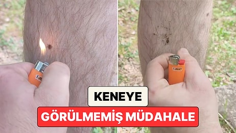 Kendisine Yapışan Keneye Çakmakla Müdahale Eden Adam İzleyenleri Şaşkına Çevirdi