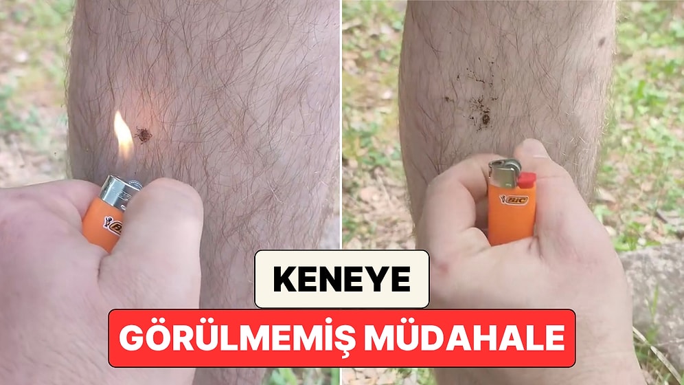Kendisine Yapışan Keneye Çakmakla Müdahale Eden Adam İzleyenleri Şaşkına Çevirdi