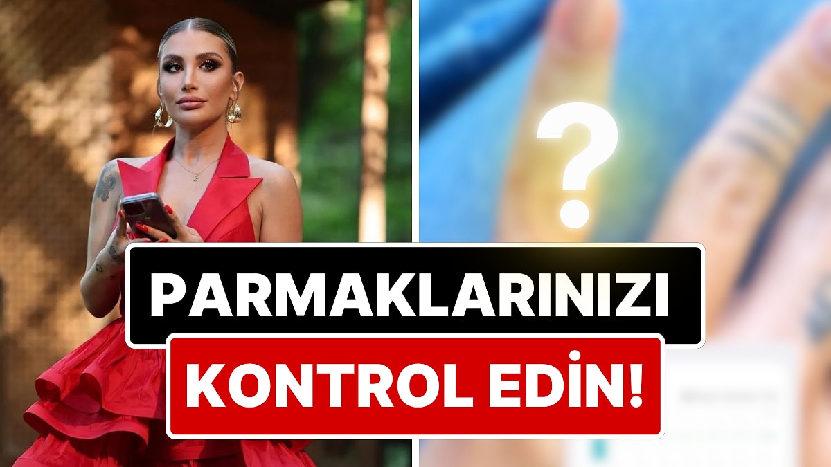 İrem Derici'nin serçe parmağı telefon yüzünden değişti