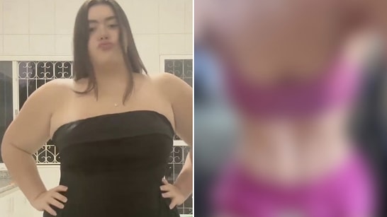 Ultimate Motivation: Woman Stuns Viewers With Incredible 91-Kilo Weight Loss Transformation