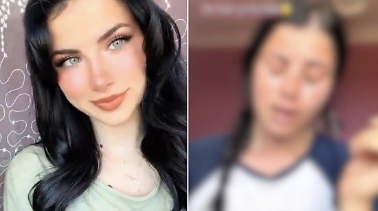 Severe Warning: Young Girl Suffers Second-Degree Facial Burns After Sleeping in the Sun