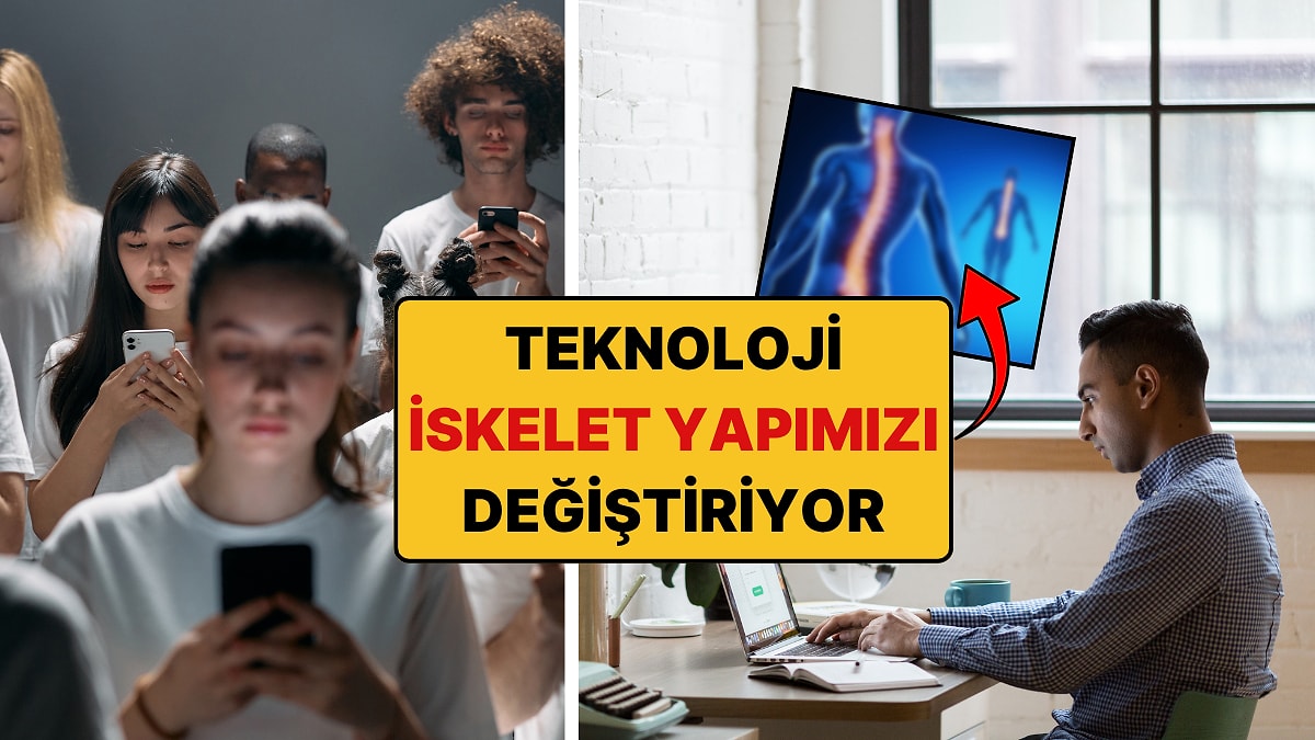 Röntgende Görünüyor: Telefonlar Gelecekteki Görüntümüzü Değiştiriyor!