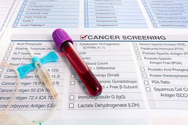 1 in Every 5 People Will Encounter Cancer!