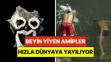 Uzmanlar Alarma Geçti: Beyin Yiyen Amip "Korku Filmi Gibi" Dünyaya Yayılıyor