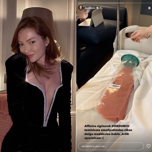 Danla Bilic, yıllar önce yaptırdığı Aquafilling kalça dolgusunun vücuduna yayılması nedeniyle uzun süredir sağlık sorunları yaşıyordu.