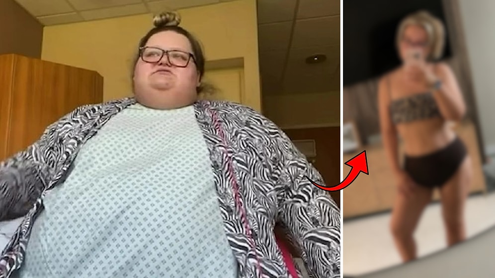 Told "You Won't See 30": Laura Budreviciene Drops From 238kg to 82kg, Losing 152kg in Miracle Shift!