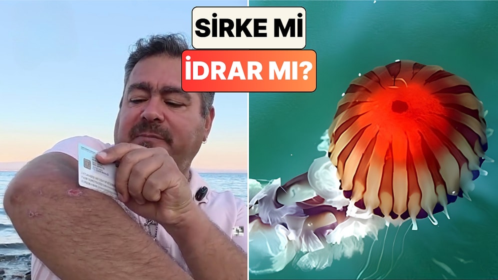 Marmara ve Çanakkale'de Denizanası Çoğaldı! Denizanası Çarpması Sonrası Ne Yapmak Gerekiyor?