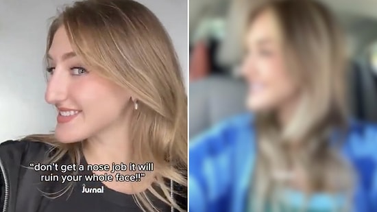 Ultimate Transformation: Woman's Incredible Nose Job Results Leave Viewers Stunned
