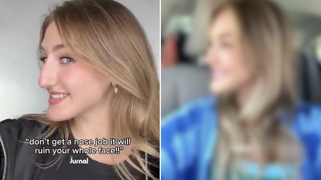 Ultimate Transformation: Woman's Incredible Nose Job Results Leave Viewers Stunned